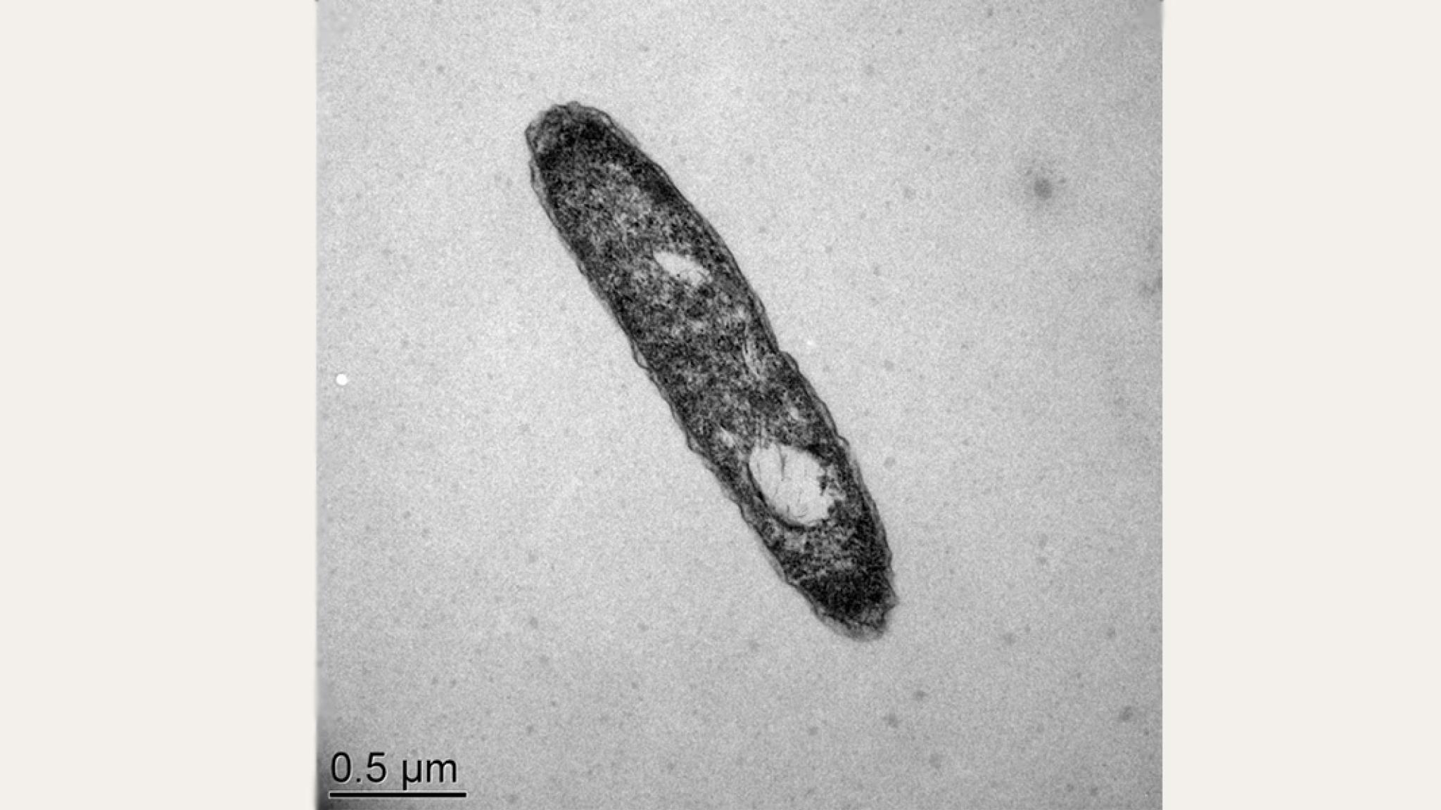 A microscopic image of the deap sea microbe Desulfatibacillum alkenivorans.