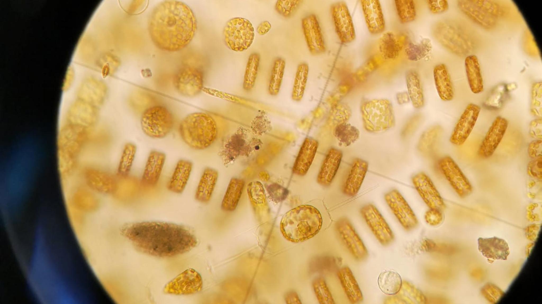 Phytoplankton under microscope (NIOZ)