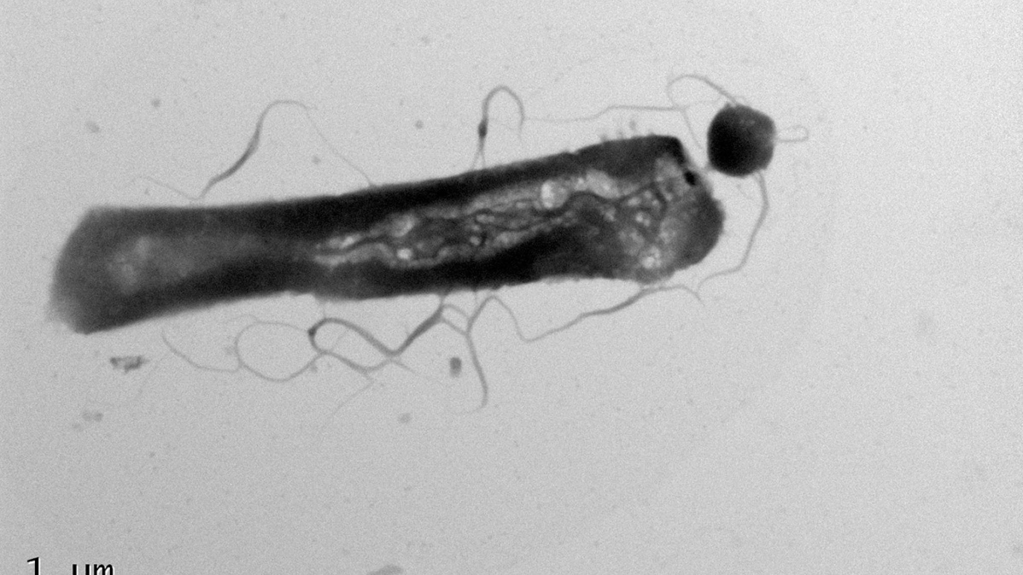 Microscopische opname van een microbe met een parasiet aan één uiteinde.