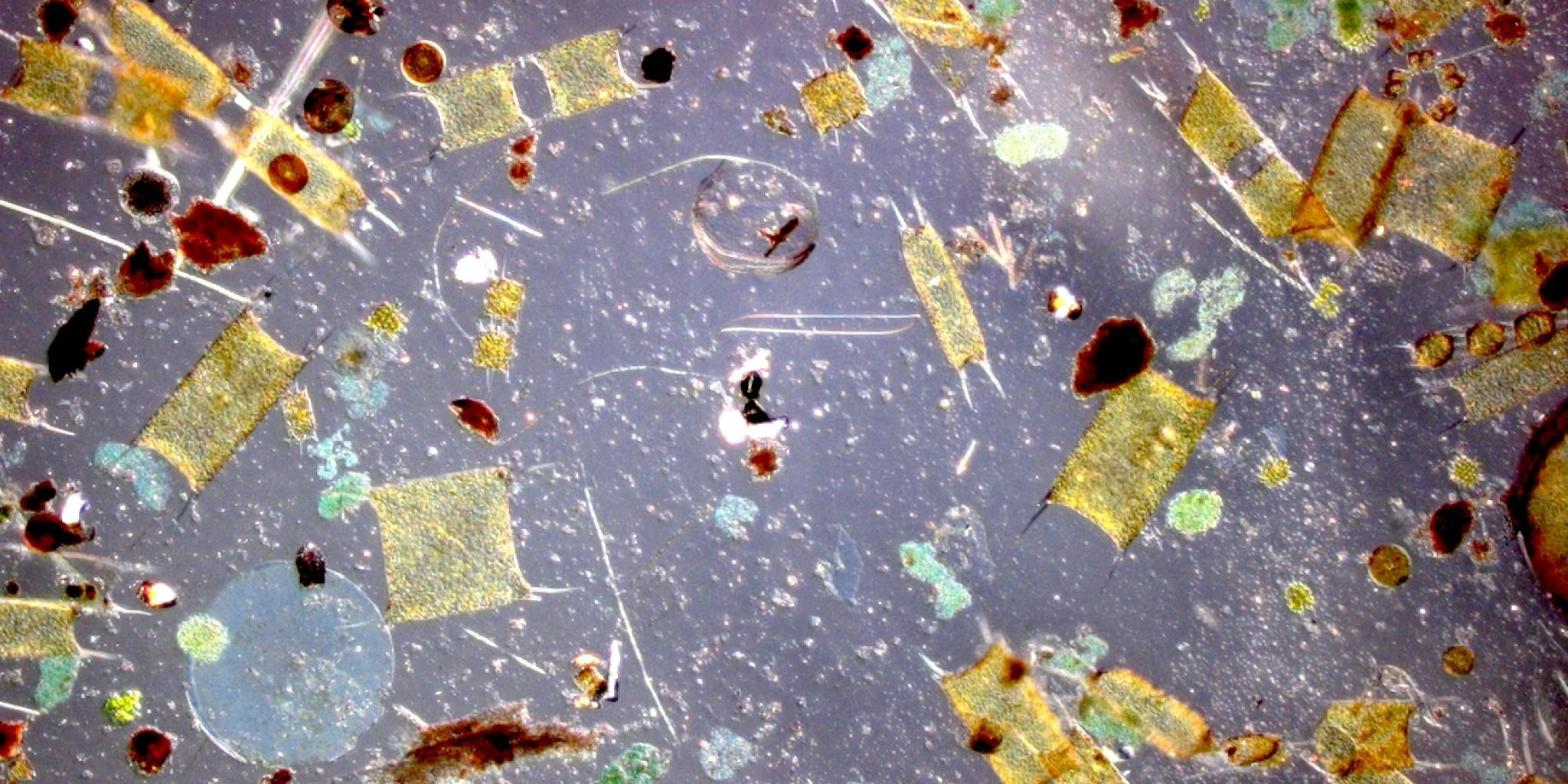 Een microscopisch beeld van algen, met verschillende semi-transparante vormen en figuren op een blauwachtige achtergrond.