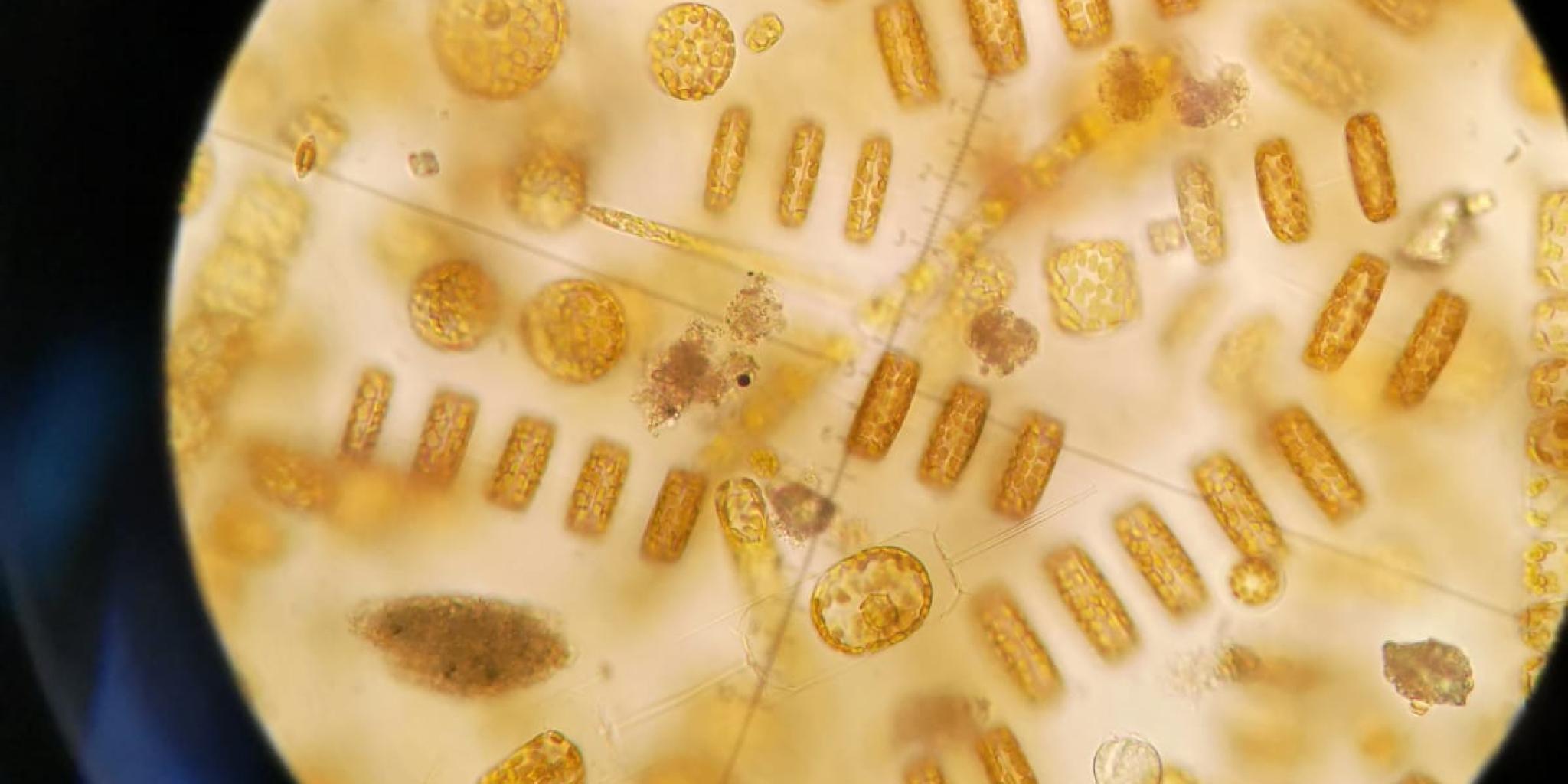 Phytoplankton under microscope (NIOZ)