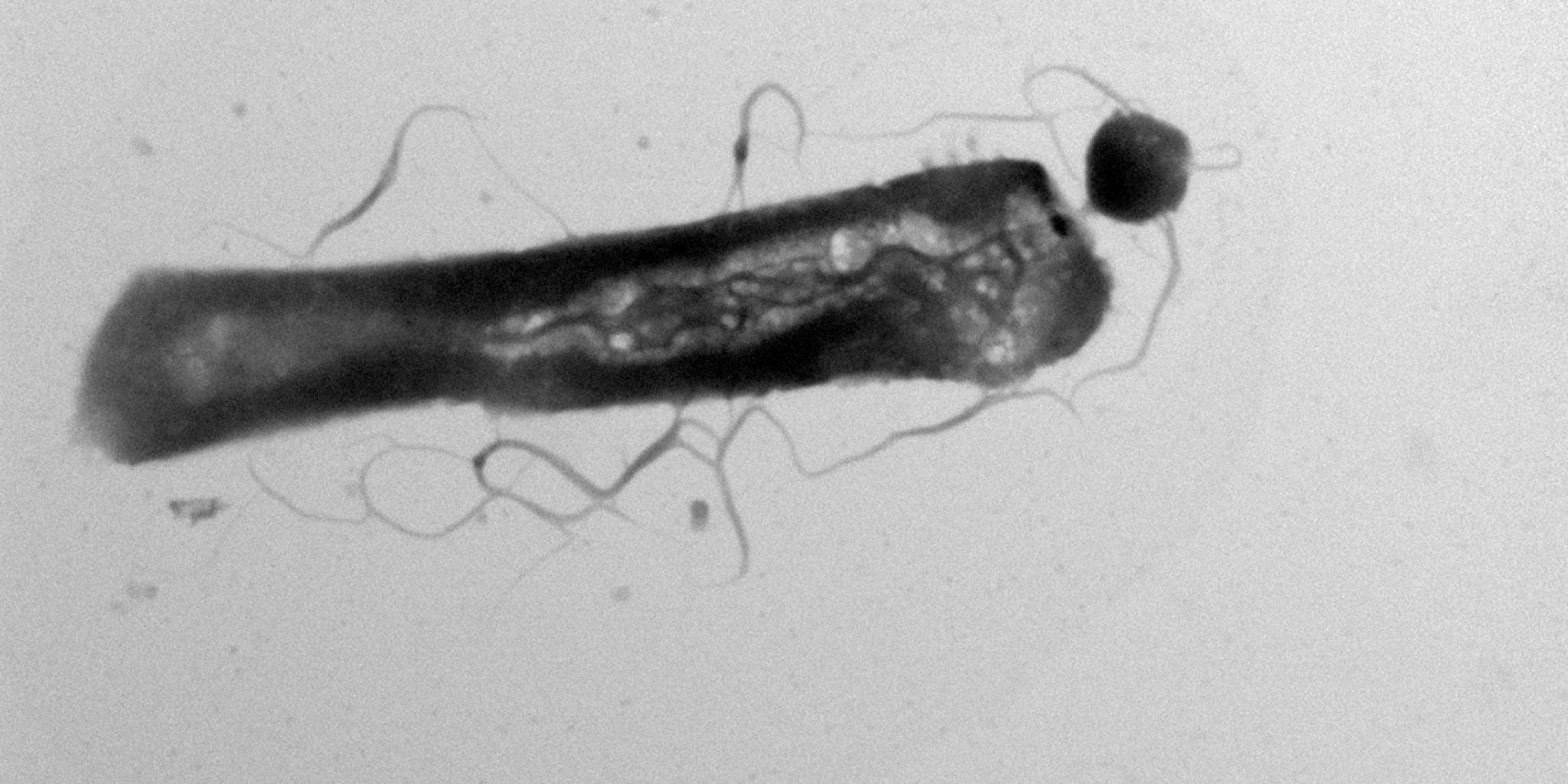 Microscopische opname van een microbe met een parasiet aan één uiteinde.
